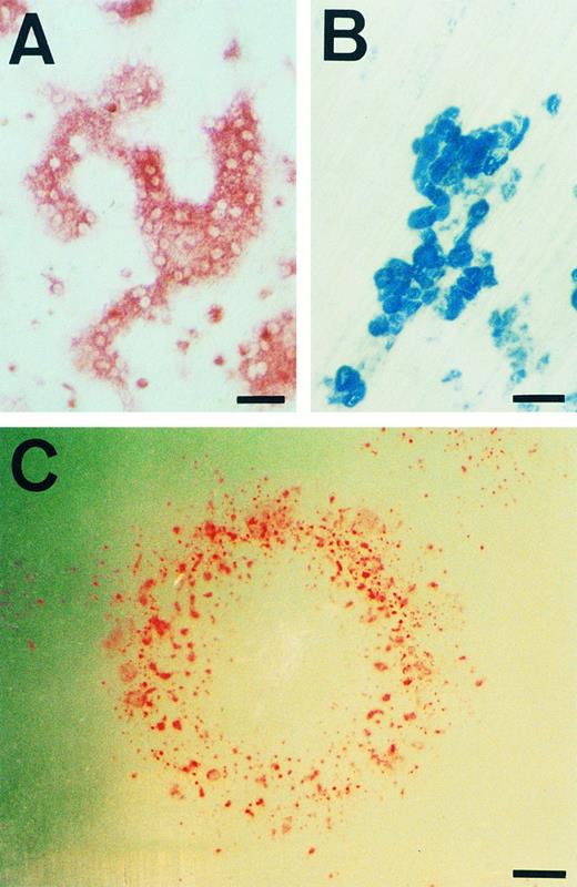 Fig. 5. Morphology and bone resorbing activity of osteoclasts. (A) TRAP staining of osteoclasts differentiated according to the culture D schedule are shown. (B) The pits formed in the dentine slice used in the experiment for first column of Table 2, indicating bone resorbing activity of osteoclasts, are shown. (C) A colony from a single ES cell generated by the culture D schedule was stained for TRAP+ cells and photographed. Note that TRAP+ cells appear in the circular edge, not inside of the colony. Scale bars: 50 μm in (A) and (B), 400 μm in (C).