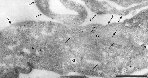 Fig. 1. Cryosection through HUVEC labeled with anti-TFPI antibodies. Antibody binding was visualized using protein A-gold particles, some of which are indicated with arrows. This micrograph shows anti-TFPI label over the Golgi complex (G) and associated with cytoplasmic vesicles (arrowheads). Surface label (s) is concentrated on the thin cellular processes. Bar = 1 μm.