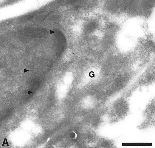 Fig. 2. Cryosections of HUVEC showing adsorption control results. The sections were incubated with anti-TFPI diluted in medium containing rTFPI, and then with protein A-gold. (A) There is no label over the region of the Golgi complex (G) even though some nonspecific label (arrowheads) is seen over the nucleus. Bar = 0.5 μm. (B) Although the adsorption control did not completely abolish labeling (arrowheads), the amount of label is reduced and no label is observed over the many intracellular vacuoles (v) characteristic of these cells. Bar = 0.5 μm.