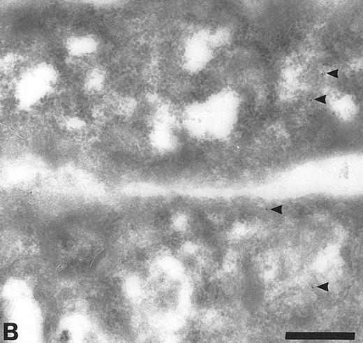 Fig. 2. Cryosections of HUVEC showing adsorption control results. The sections were incubated with anti-TFPI diluted in medium containing rTFPI, and then with protein A-gold. (A) There is no label over the region of the Golgi complex (G) even though some nonspecific label (arrowheads) is seen over the nucleus. Bar = 0.5 μm. (B) Although the adsorption control did not completely abolish labeling (arrowheads), the amount of label is reduced and no label is observed over the many intracellular vacuoles (v) characteristic of these cells. Bar = 0.5 μm.
