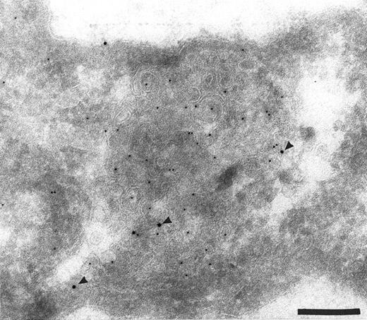 Fig. 3. Section through HUVEC incubated with DAMP before fixation. The sections were double labeled with antibodies to dinitrophenol (DNP, small gold) and with anti-TFPI (large gold, arrowheads). The anti-DNP antibodies labeled the lumen of many intracellular organelles, indicating the presence of low pH. These organelles also labeled with anti-TFPI. Bar = 0.2 μm.