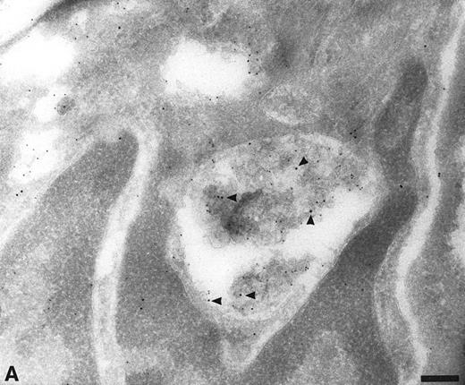 Fig. 4. Colocalization of anti-TFPI antibodies with endosomes and lysosome marker proteins on cryosections of HUVEC. (A) Cell labeled with anti-mannose-6-phosphate receptor (MPR, small gold), considered to be a marker for late endosomes. The anti-TFPI (large gold, arrowheads) labeling is present in MPR-positive structures. Bar = 0.2 μm. (B) Smaller, MPR-positive vesicles (small gold) also labeled with anti-TFPI (large gold). The anti-TFPI also labels the cell surface. Bar = 0.2 μm. (C) Cell labeled with anti-LAMP (small gold), which is found in late endosomes and lysosomes. The anti-TFPI (large gold, arrowheads) is present in LAMP 1-positive structures. Bar = 0.2 μm.