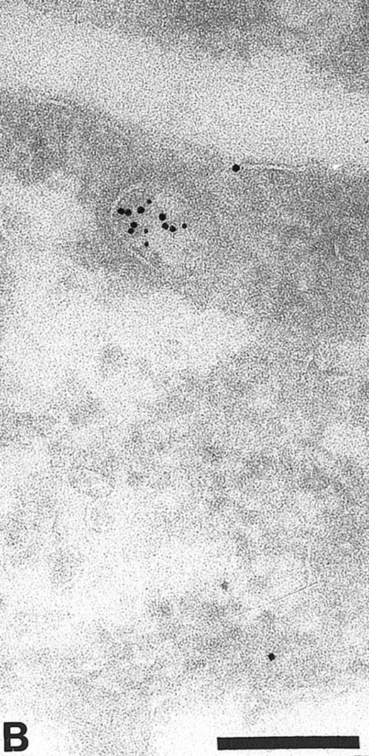 Fig. 4. Colocalization of anti-TFPI antibodies with endosomes and lysosome marker proteins on cryosections of HUVEC. (A) Cell labeled with anti-mannose-6-phosphate receptor (MPR, small gold), considered to be a marker for late endosomes. The anti-TFPI (large gold, arrowheads) labeling is present in MPR-positive structures. Bar = 0.2 μm. (B) Smaller, MPR-positive vesicles (small gold) also labeled with anti-TFPI (large gold). The anti-TFPI also labels the cell surface. Bar = 0.2 μm. (C) Cell labeled with anti-LAMP (small gold), which is found in late endosomes and lysosomes. The anti-TFPI (large gold, arrowheads) is present in LAMP 1-positive structures. Bar = 0.2 μm.