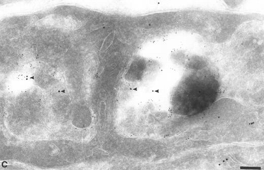 Fig. 4. Colocalization of anti-TFPI antibodies with endosomes and lysosome marker proteins on cryosections of HUVEC. (A) Cell labeled with anti-mannose-6-phosphate receptor (MPR, small gold), considered to be a marker for late endosomes. The anti-TFPI (large gold, arrowheads) labeling is present in MPR-positive structures. Bar = 0.2 μm. (B) Smaller, MPR-positive vesicles (small gold) also labeled with anti-TFPI (large gold). The anti-TFPI also labels the cell surface. Bar = 0.2 μm. (C) Cell labeled with anti-LAMP (small gold), which is found in late endosomes and lysosomes. The anti-TFPI (large gold, arrowheads) is present in LAMP 1-positive structures. Bar = 0.2 μm.