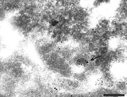 Fig. 5. Cryosections of HUVEC labeled with antibodies to human transferrin receptor (HTfR, small gold) and anti-TFPI (large gold). Transferrin receptor recycles from the cell surface via early endosomes. Small vesicles (arrows) label with anti-HTfR and anti-TFPI. Bar = 0.2 μm.