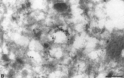 Fig. 6. Cryosections of HUVEC incubated with biotin before endocytosis and fixation. The cell surface labeled with anti-TFPI (large gold) and anti-biotin (small gold). Colocalization of anti-TFPI and anti-biotin was seen in small vesicles close to the cell surface (A, arrow) and in larger vesicles (panel B). Bars = 0.2 μm.