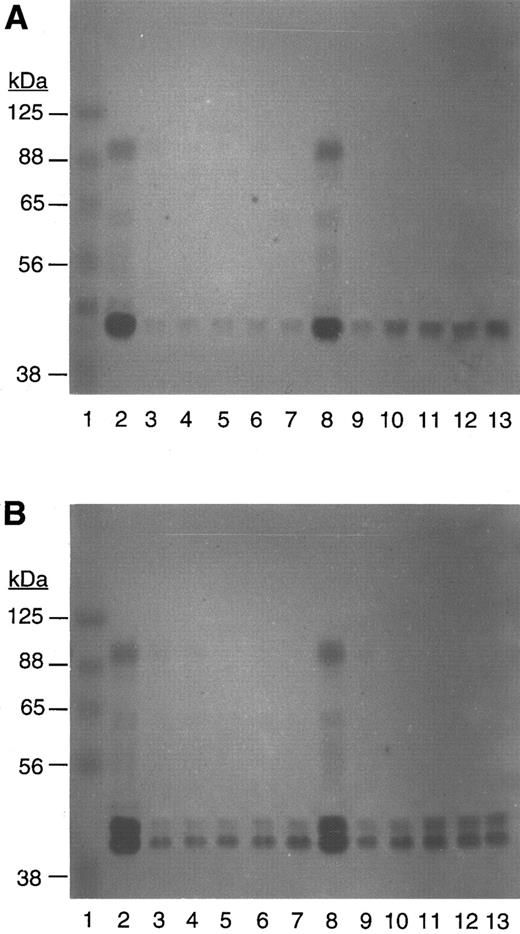 Fig. 5. Zymogram of native platelets (A) and scu-PA–enriched platelets (B) after incubation with plasminogen and S2403 in the absence or presence of thrombin. Lane 1 contains MW standards; lanes 2 to 7 are platelets after 1 hour; and lanes 8 to 13 are platelets after a 5-hour incubation with thrombin, 0,28 1 U/mL,39 2.5 U/mL,410 5 U/mL,511 10 U/mL,612 or 40 U/mL.713