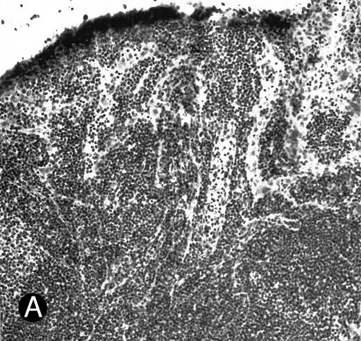 Fig. 1. WEHI78/24 cells bind to inflamed, but not normal PLN HEV. Binding of WEHI78/24 cells to normal (A) and CFA-inflamed (B) PLN HEV was assessed in modified Stamper-Woodruff frozen section assays. WEHI78/24 cells were added to freshly cut frozen sections and incubated for 30 minutes at 5°C under constant rotation. Nonadherent cells were washed away and the sections fixed and stained with thionine as described.14 A lower magnification of the normal lymph node is shown to illustrate lack of binding on multiple HEV.