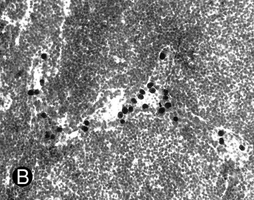 Fig. 1. WEHI78/24 cells bind to inflamed, but not normal PLN HEV. Binding of WEHI78/24 cells to normal (A) and CFA-inflamed (B) PLN HEV was assessed in modified Stamper-Woodruff frozen section assays. WEHI78/24 cells were added to freshly cut frozen sections and incubated for 30 minutes at 5°C under constant rotation. Nonadherent cells were washed away and the sections fixed and stained with thionine as described.14 A lower magnification of the normal lymph node is shown to illustrate lack of binding on multiple HEV.