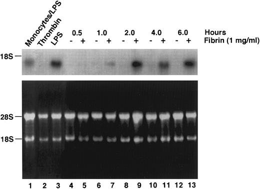 Fig. 8. Time kinetic expression of IL-8 mRNA from fibrin treated HUVEC. Northern blot analysis of IL-8 mRNA expression (top), and 28S and 18S ribosomal RNA (bottom). Lanes 4, 6, 8, 10, and 12 were RNA from HUVEC with control media for 0.5, 1.0, 2.0, 4.0, and 6.0 hours, respectively. Samples from fibrin (1 mg/mL) treated cells for 0.5, 1, 2, 4, and 6 hours were on lanes 5, 7, 9, 11, and 13, respectively. Endothelial cells treated either with thrombin (lane 2), or with LPS 5 μg/mL (lane 3) for 4 hours, and LPS treated human monocytes (lane 1) were run as controls. The RNA blot analyses are representative of two individual studies.