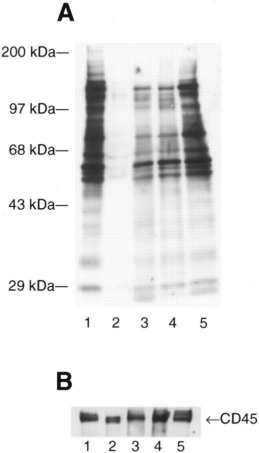 Fig. 1. Infection with HIV produces enhanced and novel patterns of phosphotyrosine-containing proteins. Activated peripheral blood lymphocytes (PBL) (lane 1), resting PBL (lane 2), and resting PBL from three patients with asymptomatic HIV infection (lanes 3 through 5) were lysed in RIPA lysis buffer, the total protein measured (Pierce), and 10 μg of total protein loaded onto each lane prior to fractionation by SDS-PAGE. The separated proteins were electrotransferred to nitrocellulose membranes and expression of phosphotyrosine (ptyr)-containing proteins analyzed by Western immunoblot. (A) Blots were probed with mouse anti-ptyr followed by goat-antimouse IgG conjugated to horseradish peroxidase. Blots were developed by enhanced chemiluminescence. Molecular mass standards are indicated on the left. (B) The blot was stripped and reprobed with anti-CD45 to confirm equal loading.