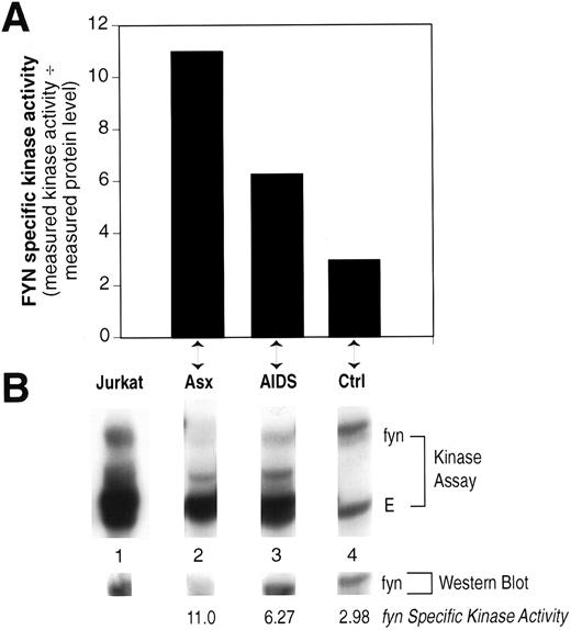 Fig. 5. Peripheral blood lymphocytes enriched for CD8+ cells show increased Fyn specific kinase activity. The relative Fyn specific kinase activity was determined as described in Fig 3 from PBMC after depletion of CD4+ cells by two rounds of anti-CD4 magnetic beads. (A) The calculated Fyn-specific kinase activity from one each asymptomatic (Asx) HIV patient, AIDS patient, and normal, HIV seronegative control (Ctrl). (B) The Kinase assay and Western blot obtained for each of the individuals in (A) compared to a human T-cell line, Jurkat. The samples were run on the same gel, transferred to Immobilon-P, the kinase result visualized by autoradiography, and then the same blot probed with monoclonal anti-Fyn by Western immunoblotting and the results visualized by ECL. The lanes were cut from the original to align properly beneath each designated sample shown in (A).