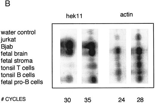 Fig. 4. Semiquantative PCR analysis of levels of Hek8, Hek11, and β-actin expression in purified lymphoid cell subpopulations. Positive controls consisted of PCR reactions on cDNA from fetal brain and the Bjab cell line, both containing high levels of Hek11 transcripts (see figs 7 and 8). Negative controls contained all components of the PCR reaction except for the target cDNA (water control). At the indicated cycle number, 5-μL aliquots were removed from the PCR reaction mixture, separated on an agarose gel, and processed for hybridization with the Hek8, Hek11, or actin probe.