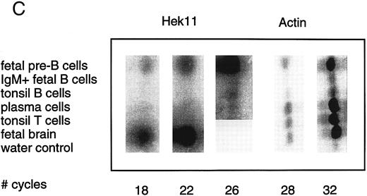 Fig. 4. Semiquantative PCR analysis of levels of Hek8, Hek11, and β-actin expression in purified lymphoid cell subpopulations. Positive controls consisted of PCR reactions on cDNA from fetal brain and the Bjab cell line, both containing high levels of Hek11 transcripts (see figs 7 and 8). Negative controls contained all components of the PCR reaction except for the target cDNA (water control). At the indicated cycle number, 5-μL aliquots were removed from the PCR reaction mixture, separated on an agarose gel, and processed for hybridization with the Hek8, Hek11, or actin probe.