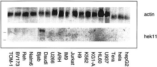 Fig. 7. Northern blot analysis of Hek11 gene expression in a panel of human hematopoietic and epithelial cell lines. Each lane contains 10 μg of total RNA. The position of 28s and 18s rRNA bands is indicated with a line (left). Hek11 expression was solely detected in the Bjab lymphoma cell line.