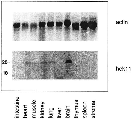 Fig. 8. Northern blot analysis of Hek11 expression in fetal human tissues. Each lane contains 10 μg of total RNA. Stroma is defined as adherent fetal BM cells cultured for 3 to 5 days. Multiple Hek11 transcripts of approximately 6.0 kb, 4.4 kb, and 2.4 kb were detectable in brain, heart, kidney, and lung.