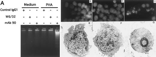 Fig. 2. MoAb90 induces apoptosis of activated T lymphocytes. (A) DNA fragmentation: PBL were incubated 3 days with medium alone (lanes 1 through 3) or PHA (5 μg/mL) (lanes 4 through 6). Dead cells were removed and viable cells were treated for 24 hours with control IgG1 (lanes 1 and 4), W6/32 (lanes 2 and 5), or MoAb90 (lanes 3 and 6) at 10 μg/mL. (B through D) Morphology of 3-day PHA-activated PBL after Hoescht 33342 staining. After 3 days of culture, PHA-activated PBL were obtained. Dead cells were removed and viable cells (106/mL) were incubated in 96-well microplates in the presence of the MoAbs. Morphology was analyzed by fluorescence microscopy. (E through G) Electronic microscopy of 3-day PHA-activated PBL. PBL were cultured during 3 days with PHA (5 μg/mL). Viable cells were then treated for 24 hours with control IgG1 (10 μg/mL) (B and E), W6/32 (10 μg/mL) (C and F ), or MoAb90 (10 μg/mL) (D and G).