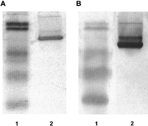 Fig. 1. Fifteen percent reducing SDS-PAGE. (A) Coomassie stained. (B) Immunoblot reacted with rabbit anti-human GM-CSF antibody. Lanes in (A) and (B): lane 1, low molecular weight prestained BioRad protein standards with molecular weights 101 kD, 83 kD, 51 kD, 36 kD, and 29 kD; lane 2, DT388–GM-CSF.