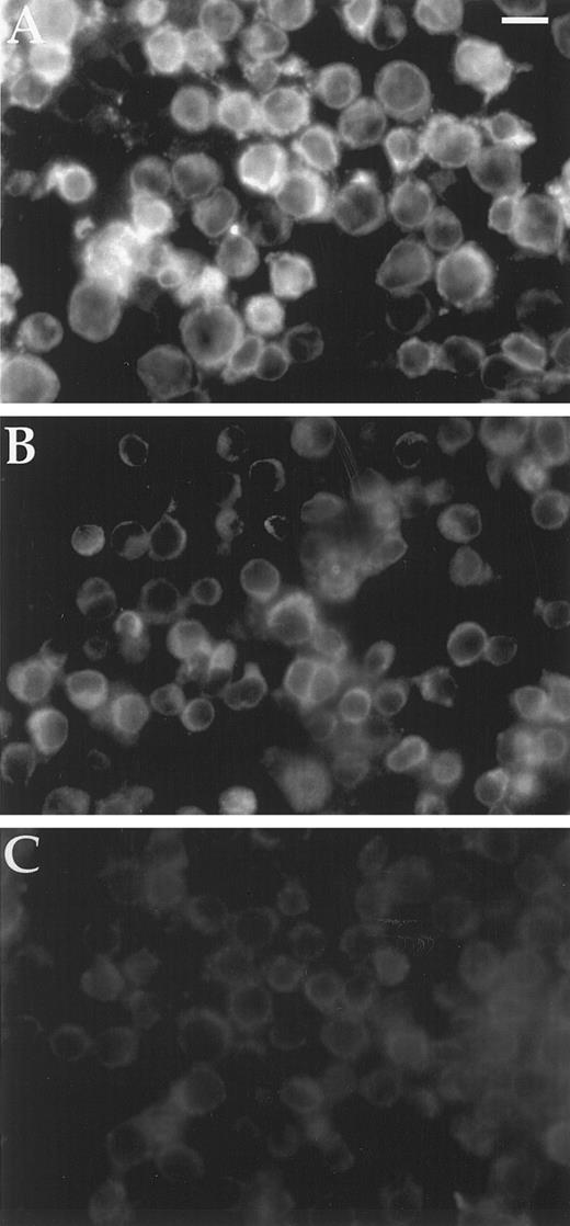 Fig. 3. Immunofluorescence assay of cellular Bcl2. Two hundred thousand cells bound to polylysine-coated 35-mm Costar dishes were washed with PBS and fixed in 3.7% formaldehyde in PBS, rinsed again with PBS, blocked with 1% BSA/0.1% saponin, and reacted with monoclonal anti-Bcl2 antibody in 1% BSA/0.1% saponin/PBS. Cells were again rinsed with PBS and bound antibody detected with rhodamine conjugated goat anti-mouse Ig. After a final rinse with PBS and postfixing in 3.7% formaldehyde, dishes were mounted in glycerol:PBS and examined under a Zeiss Axioplan epifluorescence microscope. Magnification is × 350; scale bar represents 17 μm. (A) HL60; (B) HL60/VCR; (C) HL60BclXL .