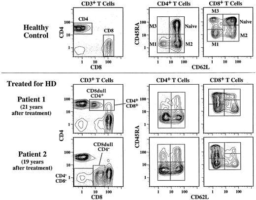 Fig. 1. CD4 and CD8 T-cell subset frequencies determined by three-color flow cytometry. To determine the CD4 and CD8 T-cell frequencies, the staining combination of CD3, CD4, and CD8 was used. The 5% probability plots shown on the left have first been gated on lymphocytes as determined by forward and side scatter, and then they have been gated on CD3 to identify T cells. In addition to CD4 and CD8 single positive T cells, CD4−CD8−, and CD4+CD8+ T cells can also be distinguished. In a few individuals treated for HD, we can identify two unusual T-cell subsets that express dull levels of CD8 and are either CD4+ or CD4−. The naive and memory CD4 and CD8 T-cell frequencies were determined by the staining combinations of CD62L, CD45RA, and either CD4 or CD8. Shown on the right are contour plots first scatter gated on lymphocytes and then gated on either CD4+ or CD8bright cells. Naive cells and three memory subsets (M1, M2, and M3) can be distinguished by this method. Shown are examples for a healthy control and two patients who were treated for HD more than 15 years before analysis. The naive T-cell depletion noted in these two individuals is typical of that seen in the posttreatment HD subjects.