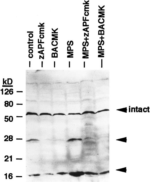 Fig. 4. Effects of protease inhibitors on lamin B1 cleavage. Cells were incubated for 6 hours in the absence or presence of 10 μmol/L methylprednisolone with or without 10 μmol/L zAPFcmk or 25 μmol/L BACMK, and lamin B1 was detected by immunoblotting. DNA fragmentation levels in these samples were quantified in parallel (by the diphenylamine assay) and are as follows: control, 8%; zAPFcmk, 3%; BACMK, 3%; MPS, 33%; MPS + zAPFcmk, 10%; MPS + BACMK, 5%. Arrows indicate positions of intact lamin B1 and two characteristic lamin fragments. Results of one experiment typical of three independent replicates.