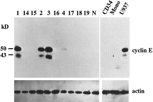 Fig. 1. The expression of cyclin E gene products. Equal amounts of whole cell lysates (10 μg) from AML blasts were applied in each lane. Full-length cyclin E is defined as the band of approximately 50 kD. Lanes number 1 to 4 correspond to the patient number in Table 2. The other 6 samples (lanes number 14 to 19) represent cyclin E− AML blasts. “N” represents the lysate from mononuclear cells in normal BM. “CD34” and “Mono” represents the lysate from enriched CD34+ cells and monocytic cells separated from normal BM by the method as described in Materials and Methods. “U937” represents the lysate from U937 cells. The blots were reprobed with anti-actin antibody to show that each sample was equally loaded.