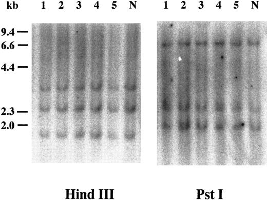 Fig. 2. Southern blot analysis of the cyclin E gene. Genomic DNAs were digested with either HindIII or Pst I, and the separated fragments were probed with human cyclin E cDNA. Each number over the lane corresponds to the patient number in Table 2. The applied amount of DNA of lane 5 in HindIII panel was small revealed by etidium bromide staining of the gel. “N” represents DNA from mononuclear cells in normal BM.