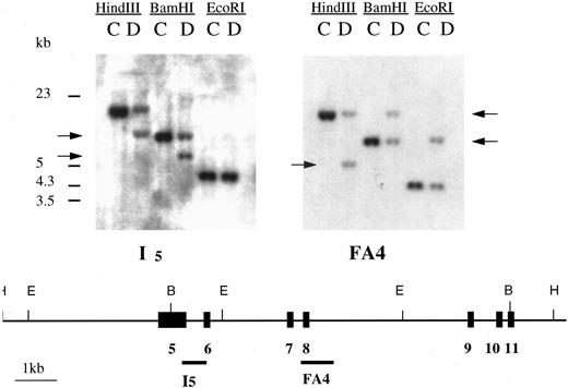 Fig. 2. Involvement of the MLL gene in the t(6; 11)(q21; q23) translocation. Top: Southern blot analysis of DNA extracted from the patient (D) and the control (C). Bottom: Partial restriction map of the MLL gene spanning exons 5 to 11 with location of the probes used in this study.