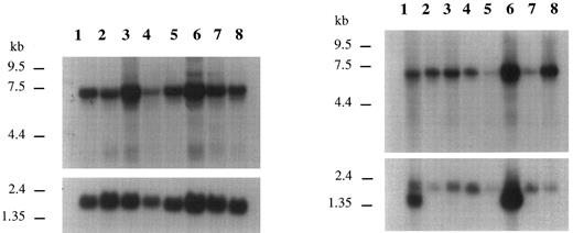 Fig. 4. Northern blot analysis of AF6q21 transcription in several human leukemic cell lines (left) and several human tissues (right) using a cDNA probe corresponding to almost all of the AF6q21 ORF. Control hybridization with an actin probe is shown at bottom. The position of size markers is indicated. Additional smaller species are detected in some samples upon longer exposure (data not shown). They could be due to variation in alternate splicing within the AF6q21 gene or to expression of a homologous gene such as the one postulated for chromosome 17. Loading is as follows: Left panel: 1, HL60; 2, HeLa; 3, K562; 4, MOLT4; 5, Raji; 6, SW480; 7, A549; 8, G361. Right panel: 1, heart; 2, brain; 3, placenta; 4, lung; 5, liver; 6, skeletal muscle; 7, kidney; 8, pancreas.