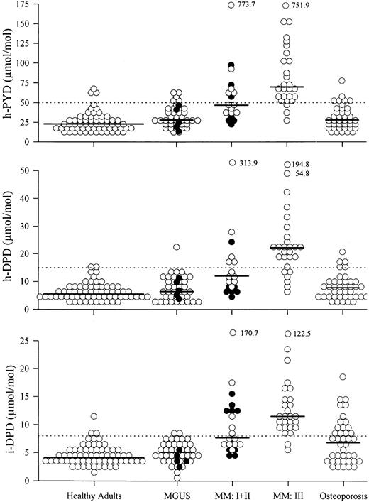 Fig. 1. Urinary excretion of pyridinium cross-links in healthy adults and patients with MGUS, MM, and osteoporosis. Patients with smoldering myeloma (•) are included in the MGUS section. MM I + II, MM patients with stage I (•) and stage II (○) disease; MM III, MM patients with stage III disease. (——) Median; (⋅⋅⋅⋅⋅) upper limit of normal range.
