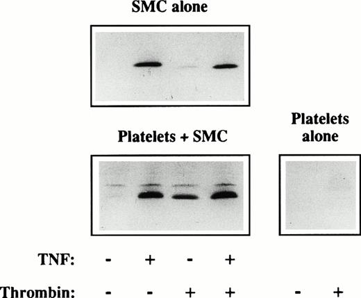 Fig. 2. Platelets induce IL-8 production of SMC. SMC were incubated in 24-well plates until they reached confluency. The cultures were washed and the SMC prestimulated with (+) or without (−) recombinant TNF-α (TNF, 50 ng/mL). Untreated (−) platelets or platelets in the presence of thrombin (+; 1 U/mL) were added at a ratio of 1,000 platelets per SMC. The supernatants were harvested after 24 hours, run on a reducing SDS-PAGE, and blotted to Immobilon P. A rabbit polyclonal antibody (IL-854-72; 1:1,000) was added (1 hour) and the blot stained with peroxidase-conjugated goat-anti-rabbit (1 hour) and subsequent addition of DAB. Similar results were obtained in three experiments.