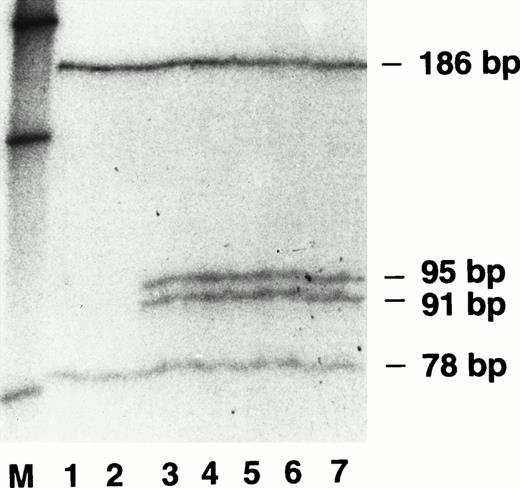 Fig. 1. Electrophoresis of Fok I-digested PCR-amplified exon 4 DNA samples from the FVII (N57D) kindred. Lanes 1 to 7 are radiolabeled, PCR-amplified DNA samples from a control and individuals II2, II1, III5, III2, III3, and IV3, respectively (see Table 1). Lane M contained radiolabeled DNA molecular weight markers of 220 bp, 154 bp, and 75 bp (top to bottom) derived from a HinfI digest of pBR322.