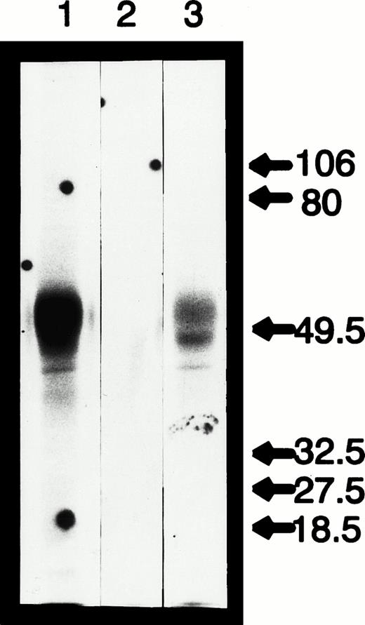 Fig. 2. PAGE analysis of radiolabeled, immunoprecipitated rFVII (N57D) protein. Lanes 1 to 3 contain immunoprecipitated protein from 293 cells expressing FVII (WT), mock transfected control, and FVII (N57D), respectively. Protein molecular weight markers ranging from 106 kD to 18.5 kD are indicated on the right.
