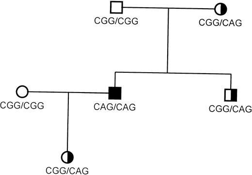 Fig. 2. Pedigree of the FXIII-deficient family studied. The inheritance pattern of the Arg408Gln, CGG → CAG mutation identified is presented. The father is homozygous normal at this sequence.