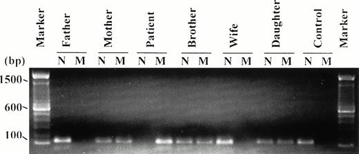 Fig. 3. ARMS-PCR products of 172 bp obtained using the normal and mutant forward primers. All relations are defined with respect to the patient. N, normal forward primer; M, mutant forward primer. The molecular weight marker used is the 100-bp ladder (BRL). Only the mutant primer gives a PCR product from the patient, indicating that the patient is mutant homozygous. Both the normal and mutant primers give PCR products from the mother, brother, and daughter, suggesting that they are all heterozygous for this mutation. The father, wife, and unrelated normal control give a PCR product with the normal primer but not with the mutant primer, confirming that they are normal homozygous. This latter pattern was obtained from all the 124 normal controls analyzed.
