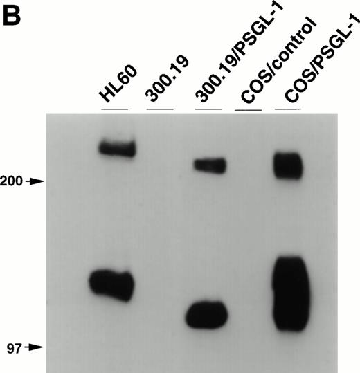 Fig. 1. Specificity of KPL1 for PSGL-1 by flow cytometry and Western blotting. (A) Untransfected 300.19 cells or 300.19 cells transfected with human PSGL-1 cDNA were stained with a negative control (top) or KPL1 (bottom) as described in Materials and Methods. KPL1 does not stain untransfected 300.19 cells, whereas it stains 300.19/PSGL-1 transfectants. (B) Western blotting of whole cell lysates made from HL60 cells (lane 1), 300.19 cells (lane 2), 300.19 cells transfected with human PSGL-1 cDNA (lane 3), COS cells transfected with a control plasmid (lane 4), or COS cells transfected with human PSGL-1 cDNA (lane 5) with the KPL1 antibody. Bands of the appropriate molecular weight (∼120 and ∼240 KD) were seen only in lysates from cells expressing PSGL-1 endogenously (HL60 cells in lane 1) or transfected with human PSGL-1 cDNA (lanes 3 and 5).