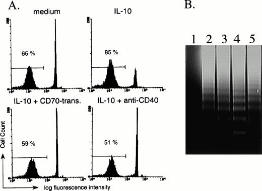 Fig. 5. CD27 signaling prevents IL-10–induced apoptosis of B cells. (A) B cells were cultured with medium alone, 100 ng/mL IL-10, IL-10 + 20% CD70 transfectants, or IL-10 + anti-CD40 MoAb (1 μg/mL). After 72 hours of incubation, the number of B cells undergoing apoptosis was determined by staining with propidium iodide, followed by analysis with flow cytometry. The percentage of apoptotic B cells is indicated. (B) DNA fragmentation was assessed by agarose gel electrophoresis. CD70 transfectants only (lane 1) and purified 2 × 106 B cells (lanes 2 to 5) were incubated in the presence of medium alone (lane 2), 100 ng/mL IL-10 (lane 3), IL-10 + mock transfectants (lane 4), or IL-10 + CD70 transfectants (lane 5). After 3-day culture, the DNA fragmentation ladder was detected. A quantity of 4 × 105 fixed transfectants were used for 1 line.