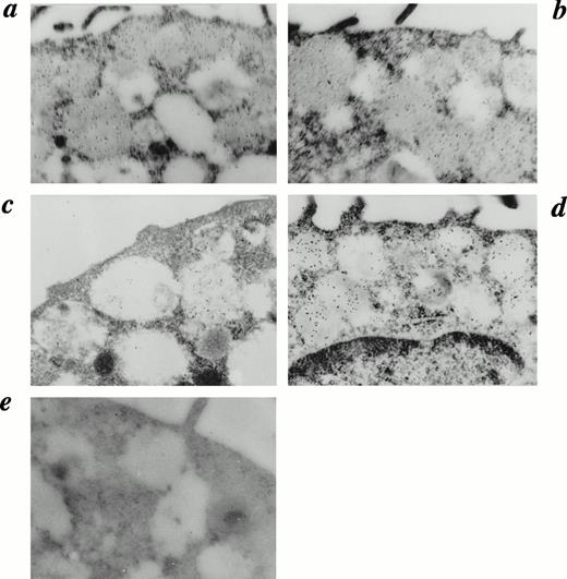 Fig. 4. Detection of chymase and tryptase in HCMCs by electron microscopic immunocytochemistry. Electron microscopic immunocytochemistry of tryptase and chymase was performed on HCMCs cultured with or without IL-4 (10 ng/mL) for 28 days in the presence of SCF (100 ng/mL) and IL-6 (80 ng/mL). The mast cell cultured without IL-4 stained with antitryptase (a) shows the same reactivity as the mast cell cultured with IL-4 (b). In contrast, the mast cell cultured without IL-4 stained with antichymase (c) shows weak reactivity compared with the mast cell cultured with IL-4 (d). Immunocytochemical control treated with mouse IgG1 instead of antitryptase or antichymase is shown (e). Representative results are shown. (Original magnification × 30,000.)