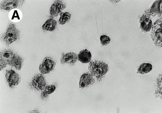 Fig. 4. Presence of IL-12 during LAK cell production generates an adherent subpopulation with a specific morphotype. In contrast to IL-2 LAKs (A), IL-12 induces the formation of granulous, large cells (B). Adherent AKR-derived LAK cells were stained with Crystal violet and photographed (original magnification × 100) in culture plate. This morphological shift can also be visualized by FACS scatter analysis of AKR-derived IL-2 A-LAK cells (C) as compared with IL-2/IL-12 A-LAK cells (E). The population with highest cellular density is situated in region 1 (R1) for IL-2 A-LAK and in region 2 (R2) for IL-2/IL-12 A-LAK. The overlay histogram (D) compares the side scatter signals of both LAK populations.