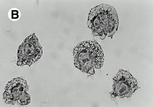 Fig. 4. Presence of IL-12 during LAK cell production generates an adherent subpopulation with a specific morphotype. In contrast to IL-2 LAKs (A), IL-12 induces the formation of granulous, large cells (B). Adherent AKR-derived LAK cells were stained with Crystal violet and photographed (original magnification × 100) in culture plate. This morphological shift can also be visualized by FACS scatter analysis of AKR-derived IL-2 A-LAK cells (C) as compared with IL-2/IL-12 A-LAK cells (E). The population with highest cellular density is situated in region 1 (R1) for IL-2 A-LAK and in region 2 (R2) for IL-2/IL-12 A-LAK. The overlay histogram (D) compares the side scatter signals of both LAK populations.