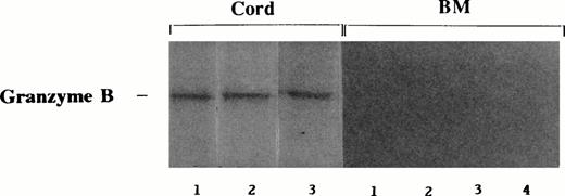 Fig. 5. Expression of granzyme B in IL-2–stimulated cord blood and BM cells. Cord blood (n = 3) and BM (n = 4) mononuclear cells were cultured in IL-2 (500 U/mL) for 3 days. Samples were extracted, electrophoresed on 15% nonreducing SDS-PAGE gel, and immunoblotted using anti-granzyme B monoclonal antibody. AEC was used to visualize immunostaining.