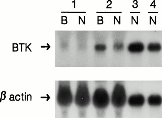 Fig. 1. Northern blot analysis. The top panel shows RNA from EBV-transformed cell lines (B) and neutrophils (N) from an XLA patient with a 4-bp deletion (1); the patient described in this study (2); an XLA patient with an amino acid substitution (3); and a normal control (4). To control for sample loading, the blot was stripped and rehybridized with a β-actin specific probe, shown in the lower panel.