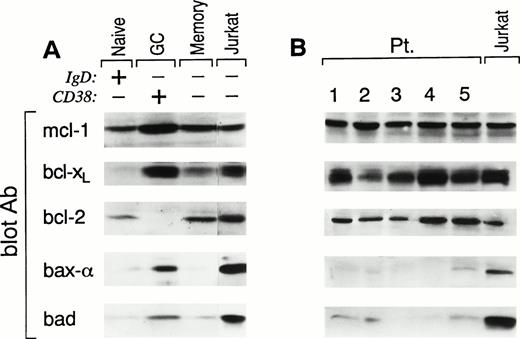 Fig. 1. Pattern of expression of bcl-2 family members in human tonsillar B-cell populations (A) and FL cells (B). Samples from (A) FACS-sorted CD38−IgD+ naive B cells, CD38+IgD− GC B cells, and CD38−IgD− memory B cells and (B) samples from highly purified FL cells of five representative patients were lysed and analyzed by SDS-PAGE and Western blotting using: anti–mcl-1 polyclonal antiserum (first panel); anti–bcl-x polyclonal antiserum (second panel); anti–bcl-2 MoAb (third panel); anti–bax polyclonal antiserum (fourth panel); or anti-bad MoAb (fifth panel). Expression of the different proteins was quantitated in each lane using a Scanner phosphoimager (Alpha Innotech Corp, San Leonardo, CA). Jurkat cell line (last lane in A and B), grown in log phase, was used as control. A total of 3 × 106 cell equivalents were used per test. Similar results were obtained when experiments were performed on tonsils or FL cells using an equivalent amount of protein per lane.