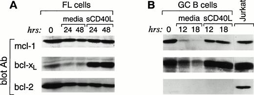 Fig. 4. Changes in bcl-xL expression in FL cells (A) and GC (B) upon culture in media alone or in the presence of sCD40L; bcl-2 levels are not affected. Highly purified FL cells (A) and FACS-sorted CD38+ GC B cells (B) were cultured in media alone or in the presence of soluble CD40L. At the indicated time intervals, cells were isolated, cell lysates were prepared, and 3 × 106 cells were analyzed by SDS-PAGE and Western blotting using anti–mcl-1 polyclonal antiserum (first panel), anti–bcl-x polyclonal antiserum (second panel), and anti–bcl-2 MoAb (third panel). Expression of the different proteins was quantitated in each lane using a Scanner phosphoimager (Alpha Innotech Corp).