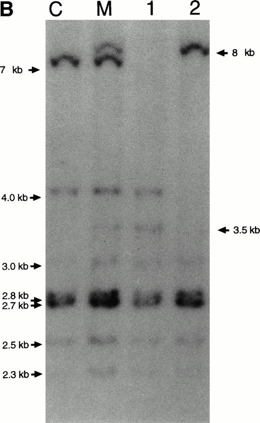 Fig. 1. Southern blot RFLP assay of genomic DNA after digestion with EcoRI. (A) Shows the EcoRI restriction map of the CYBB gene. Hybridization was performed with a 32P-labeled pSV-CGD cDNA probe, containing the entire coding region of CYBB. The length of the expected restriction fragments is indicated. (B) Shows the results with the DNA from a healthy control donor (lane C), from the mother of the patients (lane M), from the eldest patient (lane 1), and from the youngest patient (lane 2). The size of the indicated fragments was determined relative to HindIII digested phage-lambda DNA as size markers. Arrows at right point at differences between lane C and the other lanes.