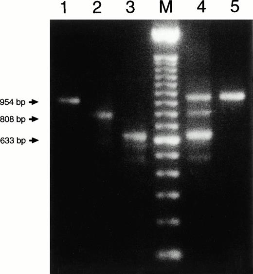 Fig. 2. Size analysis of PCR products from cDNA. Primers were chosen on exon 4 and exon 10 (Table 1). The PCR products were separated in agarose and visualized with ethidium bromide. Lane 1 contains material from a healthy control donor, lane 2 from the youngest patient, lane 3 from the eldest patient, lane 4 from the mother of the patients, and lane 5 from the maternal grandmother of the patients. Lane M contains size markers of 100 bp.