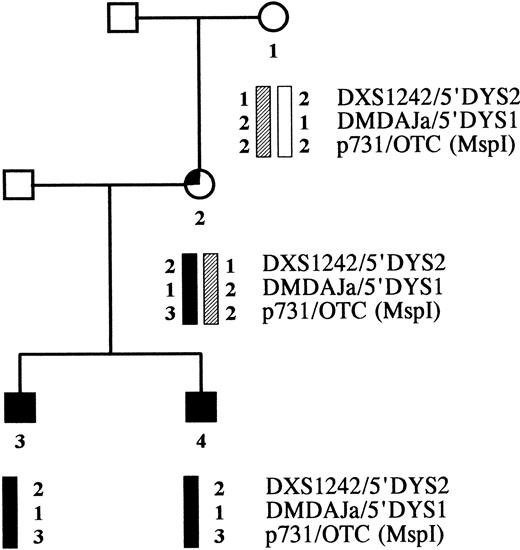 Fig. 5. Pedigree of the CGD family. Haplotype analysis was performed with X-chromosome-specific markers flanking the CYBB gene, ie, two CA repeats in the DMD gene and one Msp I polymorphism in the OTC gene.