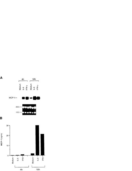 Fig. 4. Induction of MCP-1 expression by IL-6 and IFN-γ in HIV-infected U1 cells. (A) Northern blot analysis of MCP-1 expression after 4 and 18 hours of culture with medium alone, IL-6 (0.24 nmol/L), or IFN-γ (1.5 nmol/L). The results of one representative experiment of three independently performed are shown. Intermediate (11 hours) and later (36 hours) time points were evaluated in the additional two experiments, showing that baseline and cytokine-induced MCP-1 message decreases after 36 hours of culture. Ethidium bromide staining of the 18S and 28S ribosomal RNA is shown as a control for RNA loading. (B) MCP-1 secretion in supernatants harvested after 4 and 18 hours of culture from the same cells of the experiment shown in (A). Low, but detectable levels of MCP-1 were already present in the supernatants 4 hours after stimulation.