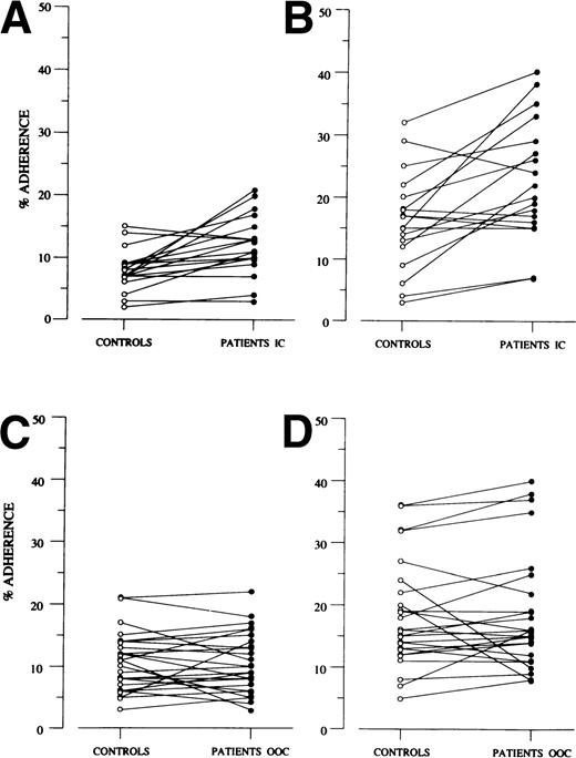 Fig. 1. Increased adherence of blood PMNs to untreated and TNF-treated cultured endothelium in sickle cell crisis. Summary of results comparing the adherence of PMNs from 18 control subjects and 18 sickle cell patients in crisis to (A) untreated and (B) TNF-treated endothelium and of PMNs from 25 control subjects and 25 patients out of crisis to (C) untreated and (D) TNF-treated endothelium. Each line represents an experiment in which PMNs from 1 patient and 1 control subject were incubated with endothelial monolayers prepared from the same umbilical cord vein. Half of the monolayers had been pretreated with 10 U/mL TNF for 4 hours. 51Cr-labeled PMNs (2 × 105/100 μL) suspended in DMEM with 10% autologous serum were added to confluent monolayers in 96-well microtiter plates. After coculture for 1 hour at 37°C, the nonadherent PMNs were removed by washing, the monolayer was lysed by 0.1 N NaOH, and the radioactivity associated with adherent PMNs was counted. The results, which are the mean value of quadruplicate measurements, are expressed as the percentage of adherent PMNs in relation to the total number of PMNs added to the monolayers. Overall, the PMNs from patients in crisis were more adherent than control PMNs to untreated endothelial monolayers (P < .001) and to TNF-treated monolayers (P = .002).