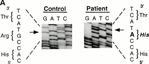 Fig. 1. Characterization of the paternal missense mutation. (A) Sequence (sense) of amplified cDNA subclones from a control (left) and the patient (right). The position of the G632 → A transition is indicated by arrows next to the sequence ladder. (B) Identification of heterozygosity for the missense mutation. DNA samples from a control (lane 1) and the patient B-LCL (lane 2) were hybridized to a radiolabeled 444-bp Rsa I-Pst I cDNA probe extending from the mutation site to the end of exon 11 afterRsa I digestion. The normal Rsa I sites are at base pair 27,276 in exon 6, 28,516 in exon 7, and 31,671 in intron 11, predicting a 3.154-kb band hybridized to the probe in normal control, while loss of Rsa I site in exon 7 results in a larger band (4.394 kb). (C) Determination of the paternal mutation. Amplified genomic fragments (739 bp) from intron 6 (base pair 28377) to intron 9 (base pair 29115) were digested with Rsa I and electrophoresed in 2.0% agarose gel, and stained with ethidium bromide. The fragment has one Rsa I recognition site at base pair 28,517 in exon 7, predicting 141- and 598-bp fragments. Loss of the Rsa I site by the mutation results in an undigested fragment.